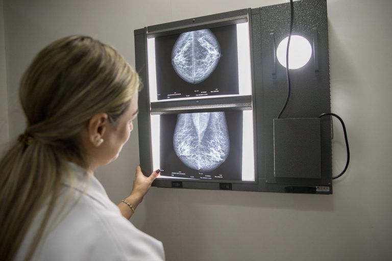ONG Oncoguia afirma que número de mamografias caiu pela metade entre 2019 e 2020 - (Foto: Divulgação/Governo de São Paulo)