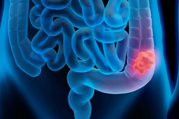 Foto: Oncoclínicas